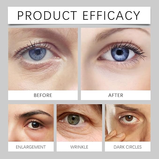 2PCS Under Eye Treatment Stick for Under Eye Bags, Hydrating for Dark Circles, Fine Lines, For Puffiness and Bags Reduce