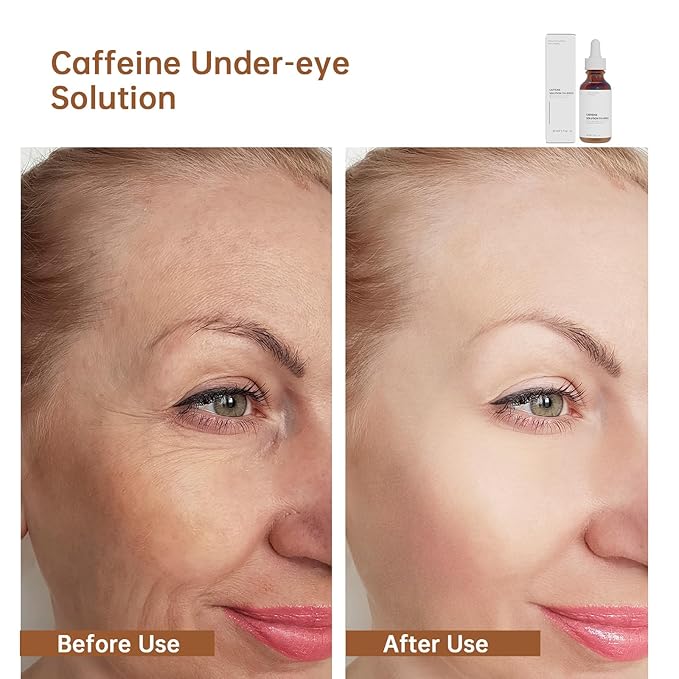Caffeine Solution 5% + EGCG For Face, 30ML 2 PCS Moisturizing Caffeine Eye Serum For Dark Circles & Puffiness, Anti-aging Caffeine Serum.