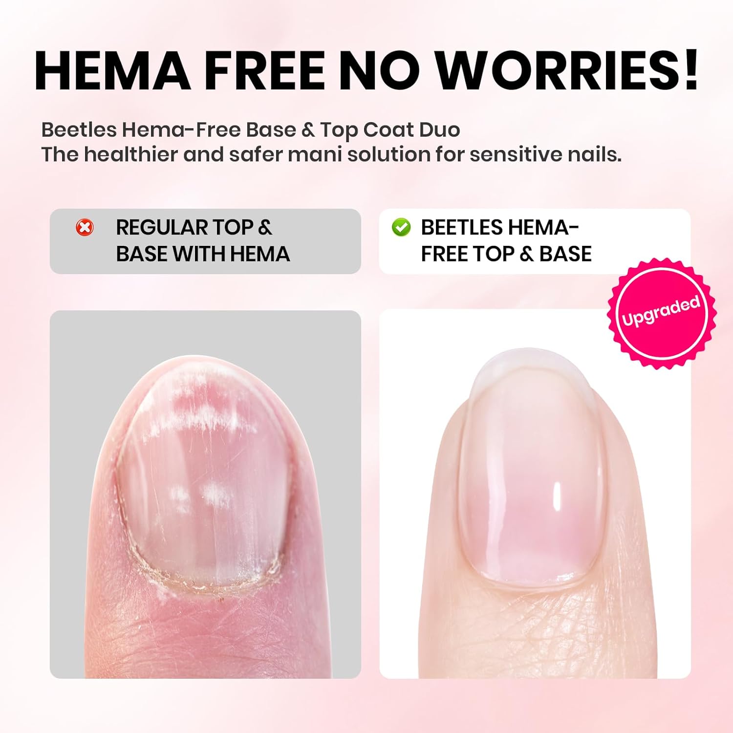 Beetles 15ml Gel Base and Top Coat Set HEMA Free, TPO Free Top Coat Gel Nail Polish & Base Clear Glossy Long Lasting No Wipe Soak Off Upgraded Safe Low-Sensitivity, No More Damaged Gifts for Women