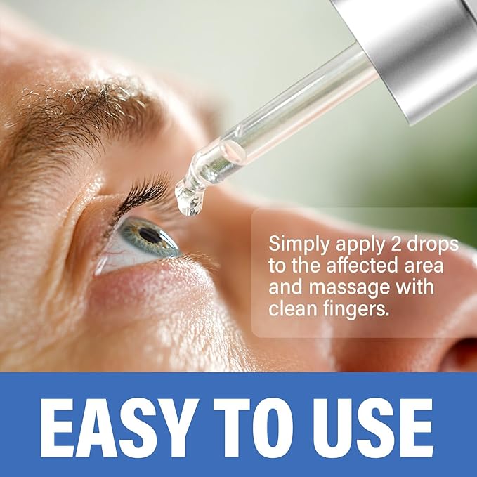 St＿ye Eye Treatment, Natural Eye Serum for Chalazion and Blepharitis Treatment, Leading to Soothed and Restored E-ye Areas, 1 Fl.oz