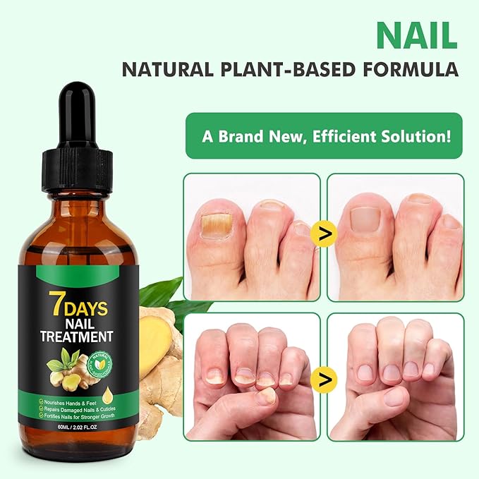 Ginger Nail Serum,Nail Growth Serum, Ginger Cuticle Care Oil for Strengthen Nails & Promote Nail Growth, Natural Plant Formula 2 Fl.oz