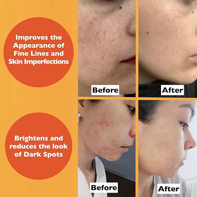 Vitamin C Serum For Face – Anti-Aging Facial Serum with Vitamin C, Hyaluronic Acid, Niacinamide, B5 & Vit E. Brightening Facial Essence for Dark Spots, Fine Lines, Wrinkles & Glowing Skin, 2 Fl Oz