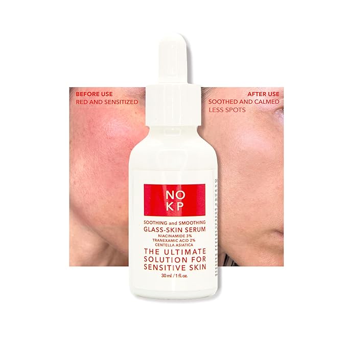 Glass skin anti-redness soothing and smoothing serum for glowy skin, Calming Serum for Face and Body, Relieves skin redness and Rosacea with Centella Asiatica (Tiger grass), aloe, panthenol