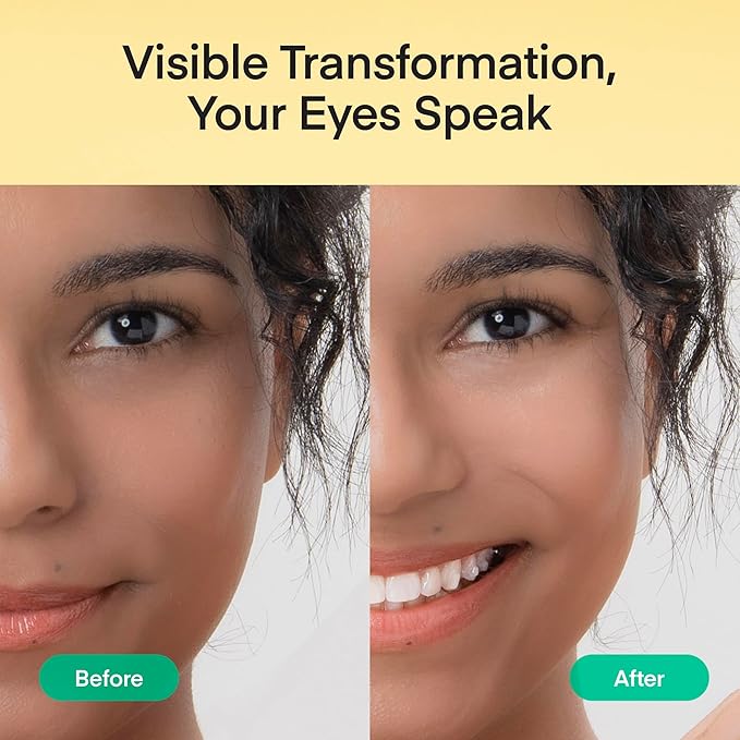 Under Eye Patches Korean Skincare: Self Care Kit for Puffy Eyes, Dark Circles, Fine Lines & Wrinkles - 180 Pcs Hydrogel Eye Mask with Collagen, Caffeine, Hyaluronic Acid & Vitamin C for Radiant Eyes