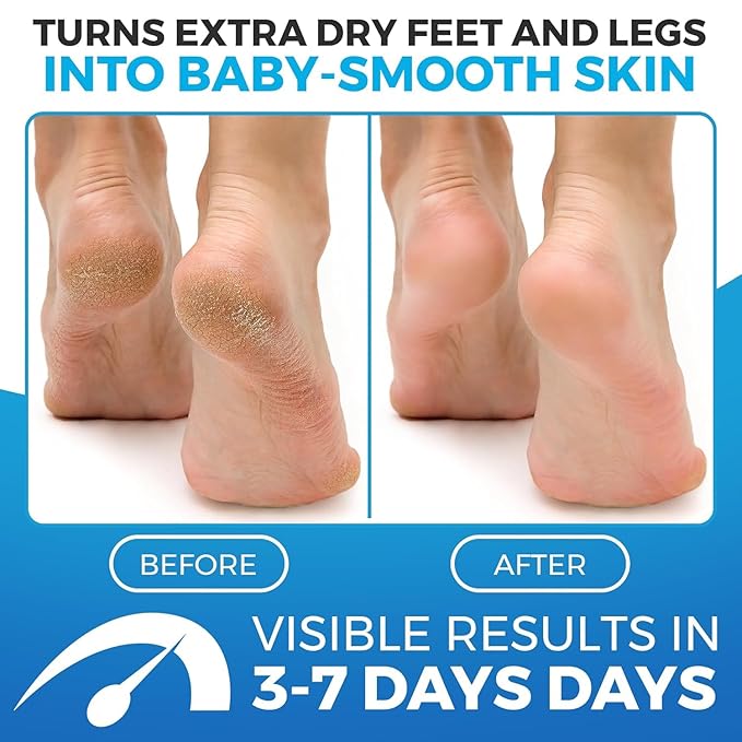 Imperial Feet Foot Balm Green - 150ml Non-Sticky Cream for Dry Feet & Cracked Skin - Aloe Vera Moisturizer for Diabetics - Soothing Hydration & Dryness Skin Repair for Hands, Feet, Legs & Overall Care