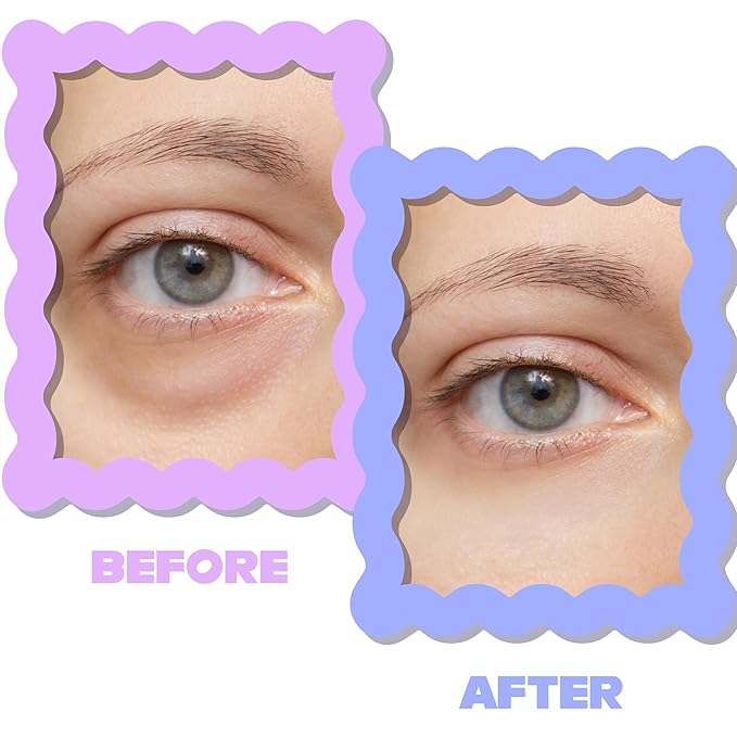 DIAMOND GAZE Under Eye Patches 28 Pairs, Rejuvenate Eye Area, Soothing Hydrate Brighten Skin, Plumps Fine Lines, Hydrogel Eye Mask with Retinol, Niacinamide and Polyglutamic Acid, Eye Gel Pads