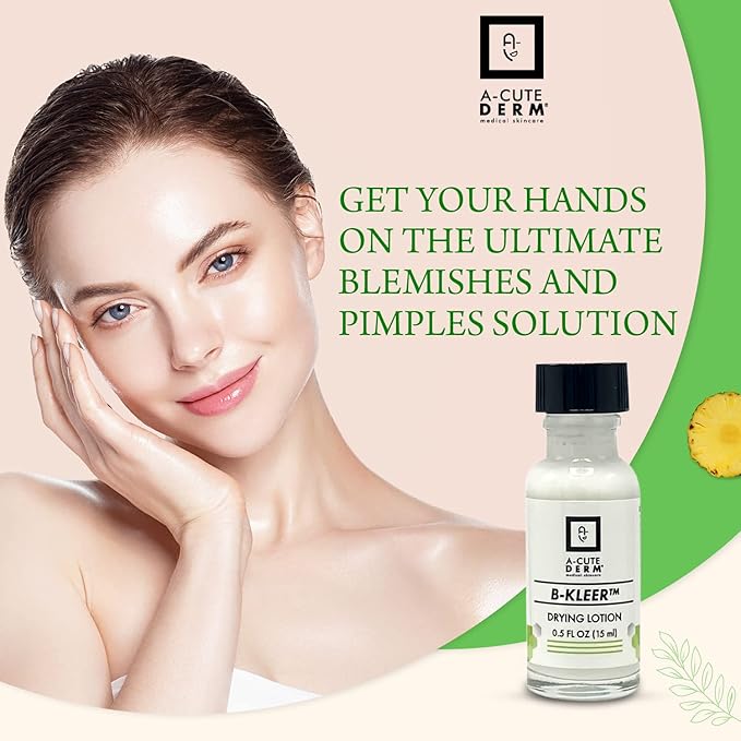 A-Cute Derm B-Kleer Drying Lotion (0.5oz)