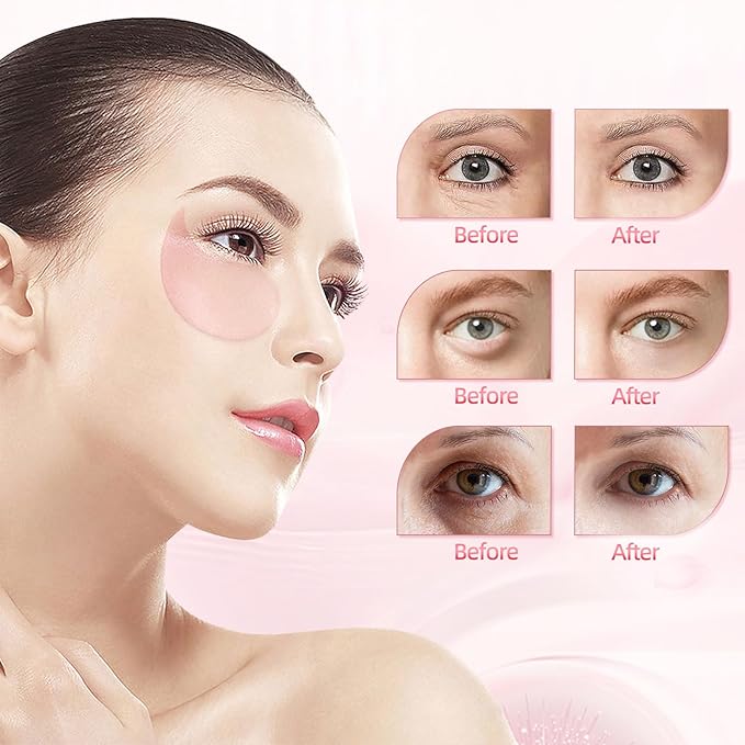 Under Eye Patches (30 Pairs), Eye Mask for Puffy Eyes, Dark Circles,Bags and Wrinkles with Collagen,Relieves Pressure and Reduces Wrinkles