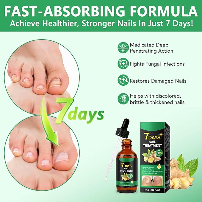 Ginger Nail Serum,Nail Growth Serum, Ginger Cuticle Care Oil for Strengthen Nails & Promote Nail Growth, Natural Plant Formula 2 Fl.oz