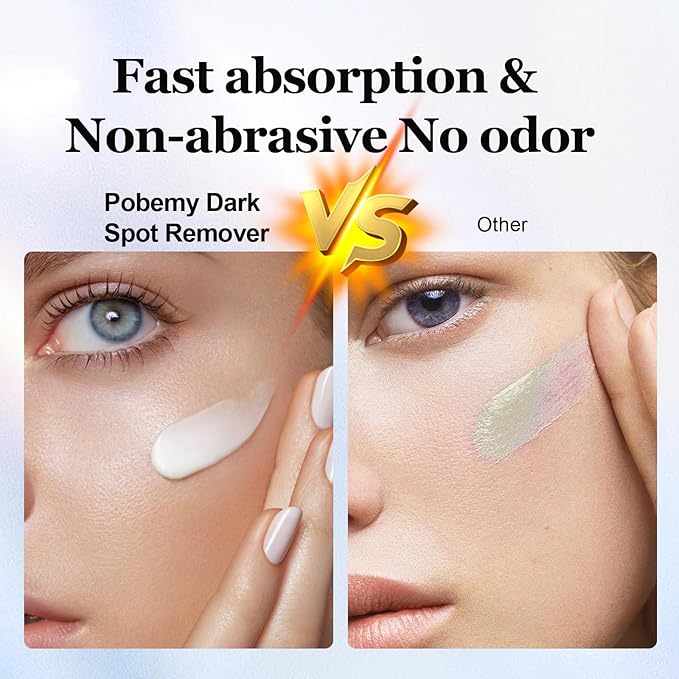 Dark Spot Remover for Face Body, Dark Spot Corrector Cream for Sun Spots, Age Spots, Brown Spots, Melasma Natural Dark Spot Remover Skin Care with Niacinamide Vitamin C for Women (1.0 Fl Oz)