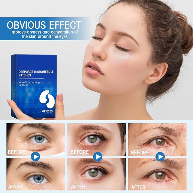 Malora Microglow Eye Patches, Malora Eye Patch, Microglow Patches, Everver Glowup Deep Care Microglow Patches, Women Face Wrinkles Deep Care Microglows Mask Set for Hydration & Soothing(2 Box)