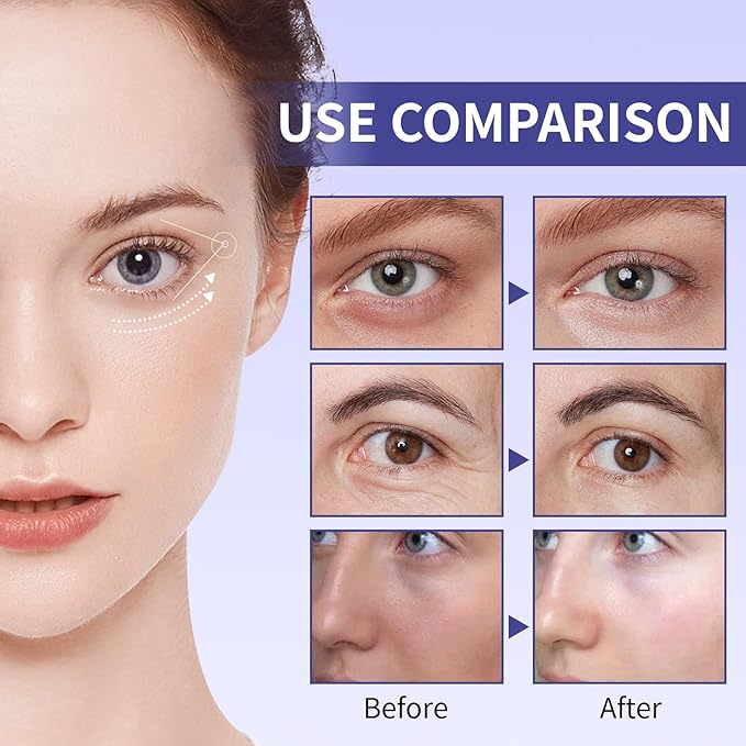 Retinol Under Eye Cream for Dark Circles and Under Eye Puffiness, Eye Repair Cream, 2 PCS Anti-Aging Hyaluronic Acid, Collagen Reduce Wrinkles Eye Cream, Lift, Firm Eyes Skin