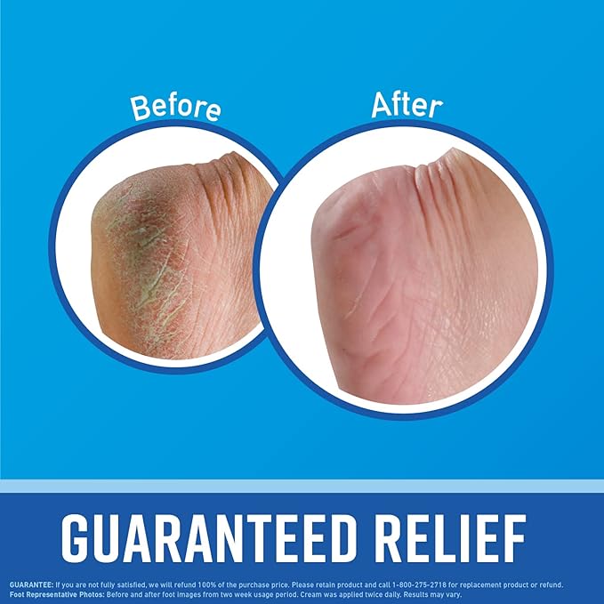 O'Keeffe's for Healthy Feet Foot Cream - 3.2 oz Jar (12 Pack) - Guaranteed Relief for Extremely Cracked, Dry Feet, Repairing Skincare, Instantly Boosts and Retains Moisture Levels