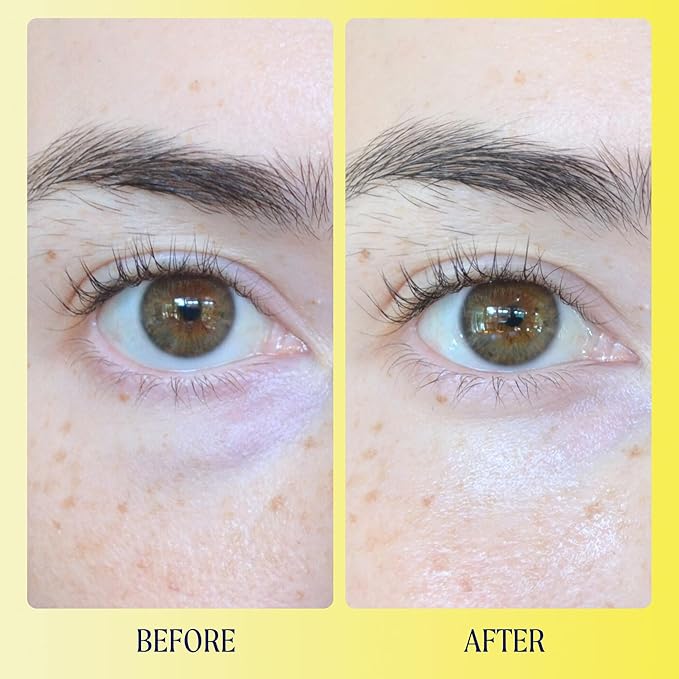 Kinship Brightwave Vitamin C Energizing + Brightening Eye Cream - Reduce Dark Circles & Puffiness - Diminishes Fine Lines & Under Eye Bags - Hydrating w/Antioxidants - Fragrance Free (0.5 Oz)