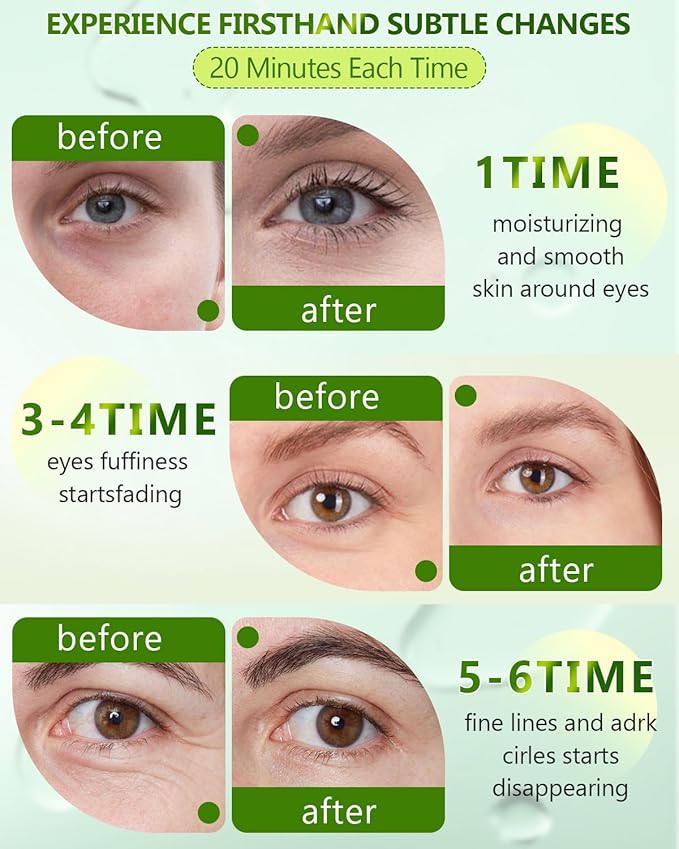 120 Pcs Chlorella Eye Patches,Collagen Under Eye Mask for Puffy Eyes & Dark Circles, Combat Fine Lines and Wrinkles,Non-Irritating Under Eye Patches