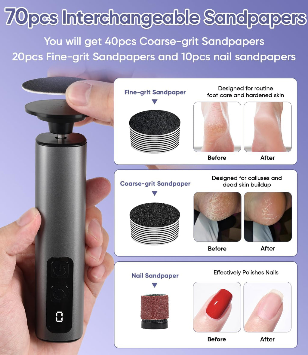 Electric Foot Callus Remover - 9 Speed Callus Remover for Feet with USB Rechargeable,Electric Foot File Pedicure Tools for Feet Dead Skin Heel Callus Hardskin Dry Cracks for Women Men (Dark Gray)