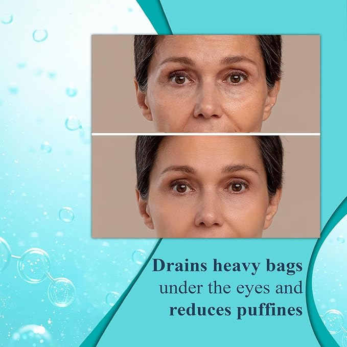 Elite Serum Rx - Anti Aging Under Eye Serum for Dark Circles and Puffiness with 7 Patented Peptides - Extra Strength Eye Lifting and Firming Serum for Wrinkle Repair and Eye Bags Treatment