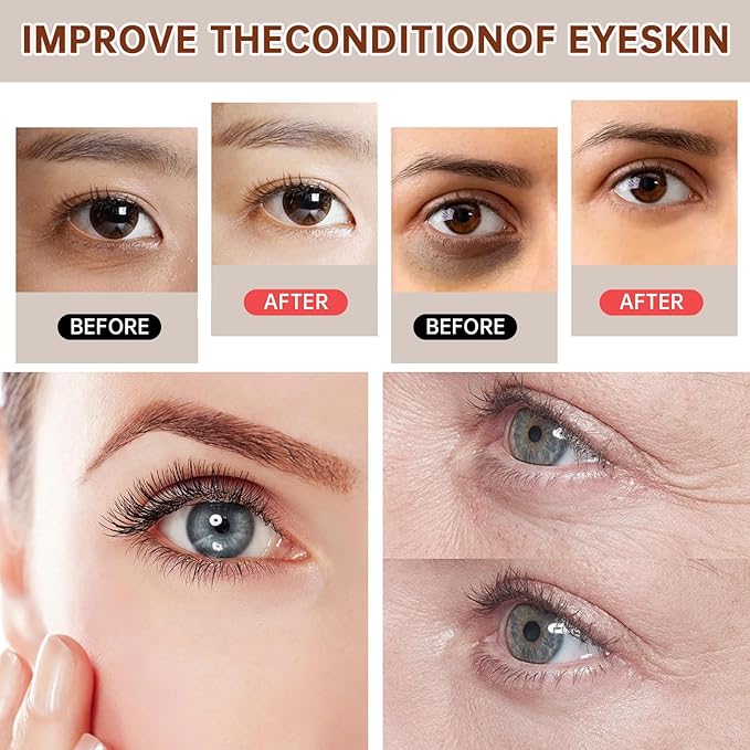 The Caffeine Solution 5% + EGCG，Reduces Appearance of Eye Contour Pigmentation and Puffiness，Under Eye Serum (30ml) Caffeine For Face Moisturizing Serum (1)