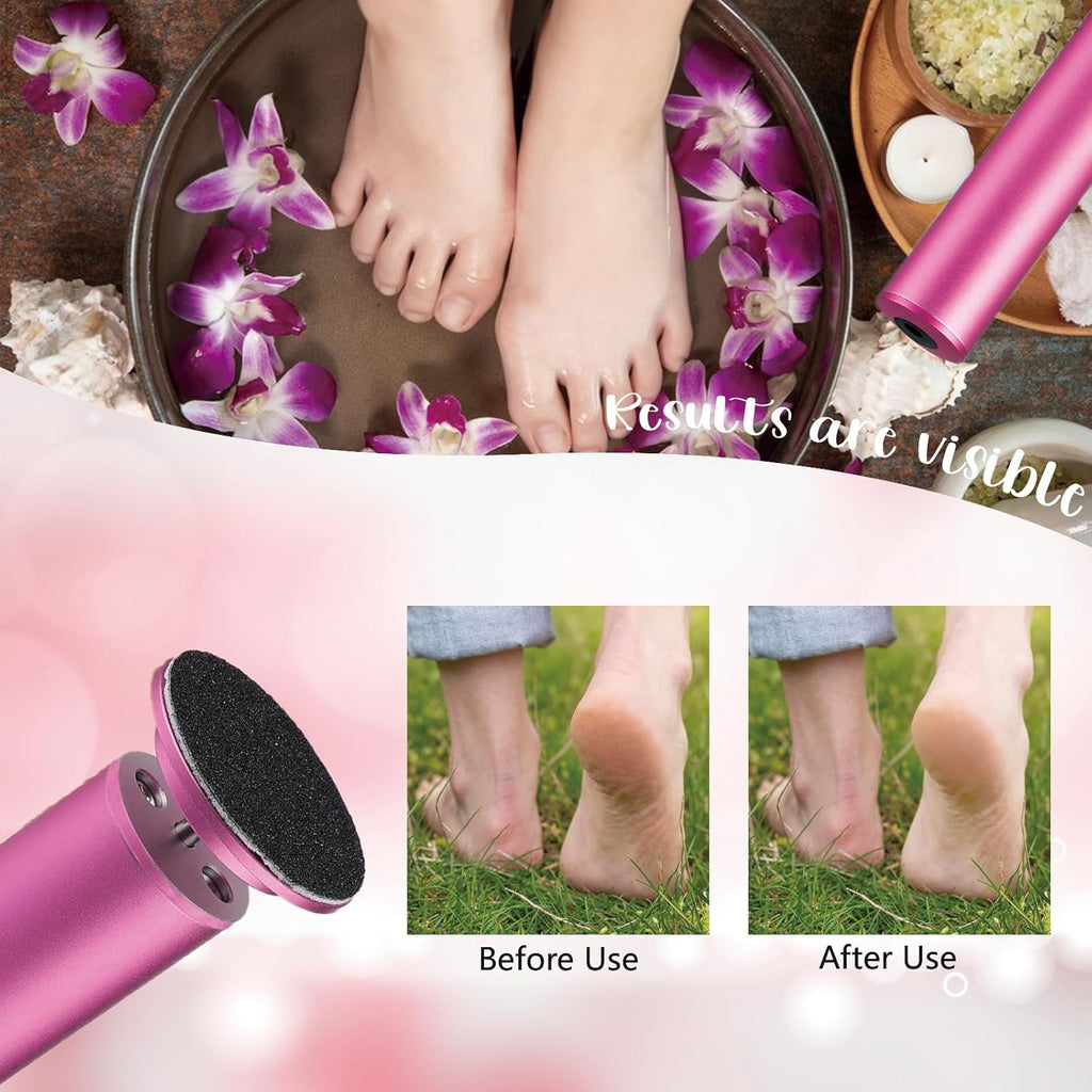 Dermave Upgraded Electric Callus Remover for Feet,Electric Foot File Feet Sander ,Adjustable Speed Foot Scrubber,Women Men Dead Skin and Cracked Professional Pedicure Tool,60Pcs Sandpaper Discs