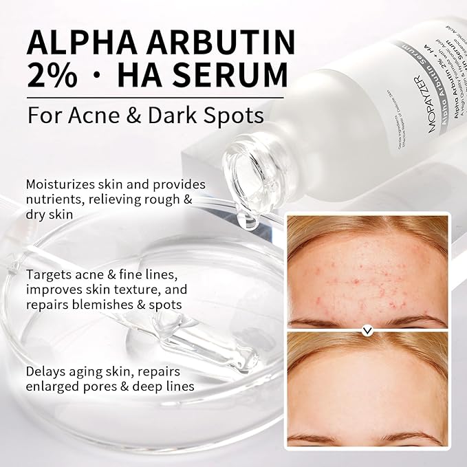 Alpha Arbutin 2% + HA Serum for Anti Aging & Wrinkles, 2 PCS Moisturizing Alpha Arbutin Serum 2%, Hyaluronic Acid, Niacinamide for Acne & Spots, Hyaluronic Acid Essence for Face.