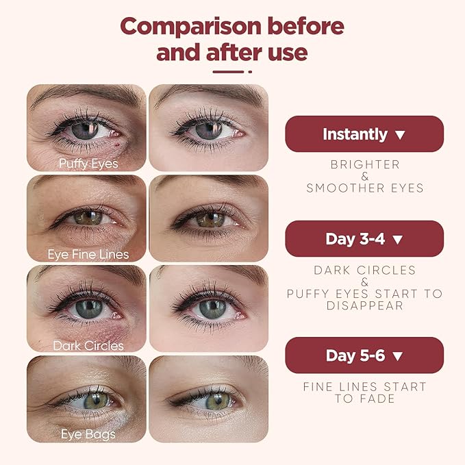 Under Eye Patches (20 Pairs), pink Hyaluronic Acid Eye Patches For Puffy Eyes, Dark Circles, Puffiness, Refresh,Revitalizing, Wrinkles, Anti Aging & Face Moisturizer For Women and Men.