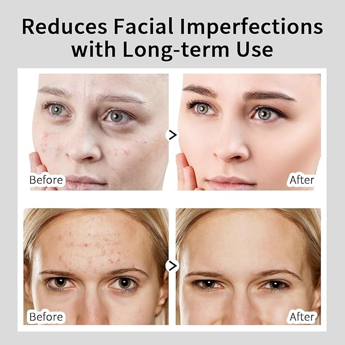 Alpha Arbutin 2% + HA Serum for Anti Aging & Wrinkles, 2 PCS Moisturizing Alpha Arbutin Serum 2%, Hyaluronic Acid, Niacinamide for Acne & Spots, Hyaluronic Acid Essence for Face.