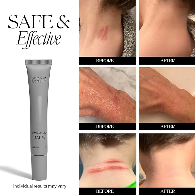 Doctor Rogers Restore Healing Balm. Multi-Purpose Healing Ointment & Moisturizing Eczema Relief Gel. Protects & Soothes Injured, Sensitive & Dry Skin 0.5 Ounce Tube (14 gram)