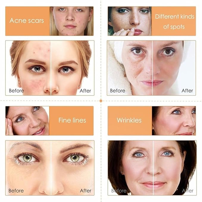 Vitamin C Skin Care Sets & Kits, Skincare Gift Set for Teenage Girls, Women Beauty Gift Sets Skin Care Kit with Cleanser,Toner,Serum,Face Cream, Long Lasting Moisturizing Skincare Set for Women Girls