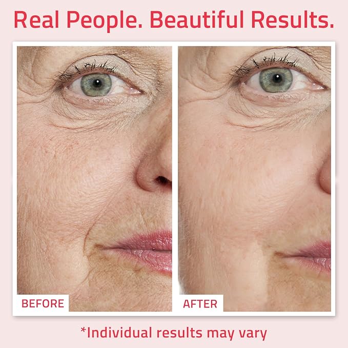 YEOUTH Retinol Serum for Face with Hyaluronic Acid & Vitamin E, Hydrating Retinol for Face, Night Serum Suitable for All Skin Types 2oz