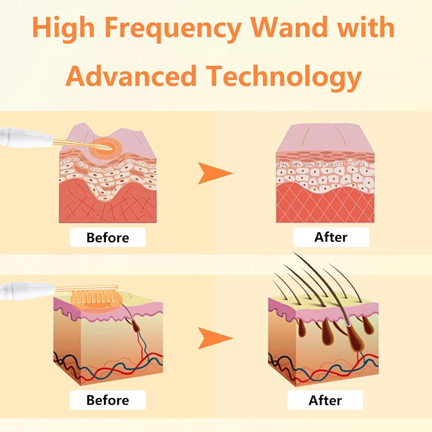 High F Rrequency Facial Wand for Face Care, Multi-Function Face Device Machine