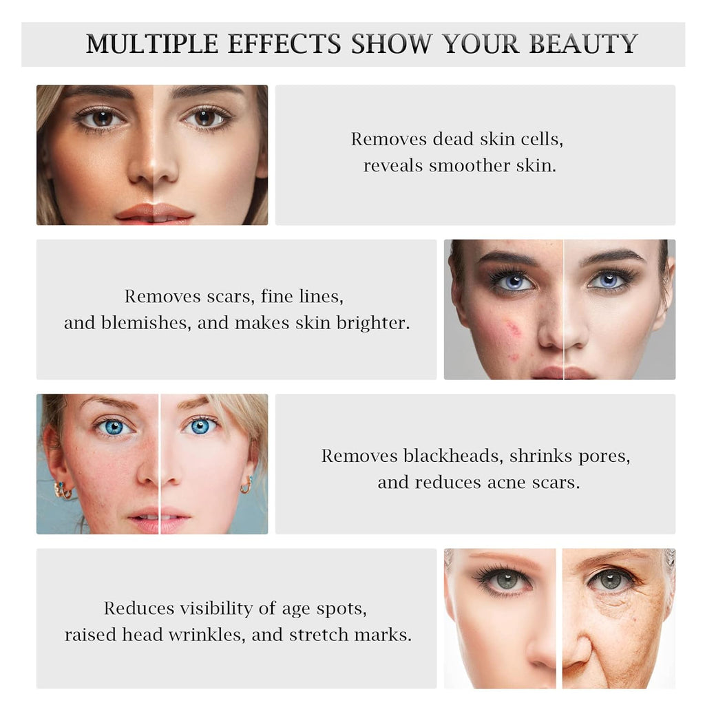 3 in 1 Diamond Microdermabrasion Machine, Professional Microdermabrasion Device with Vacuum Spray, Beauty Facial Skin Care Dermabrasion Equipment for Salon Personal Home Use