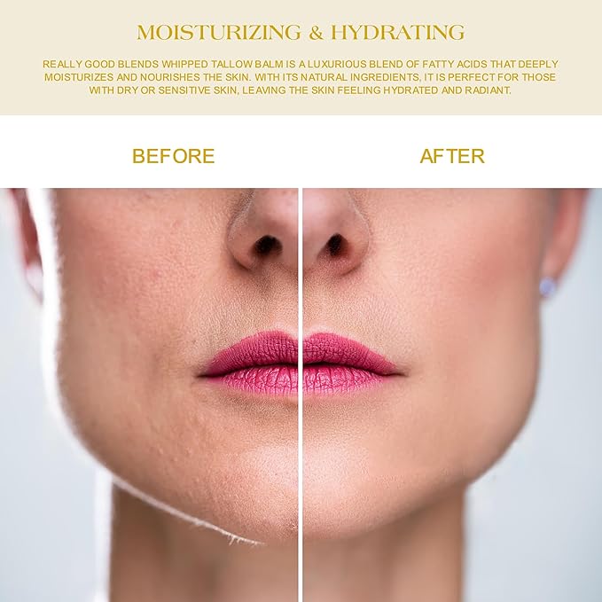 Handmade Whipped Tallow Balm for Skin Care- All Natural Grass Fed Beef Tallow All Purpose Balm,Face and Body Moisturizing Cream, Tallow Balm For Dry Skin- 2 oz