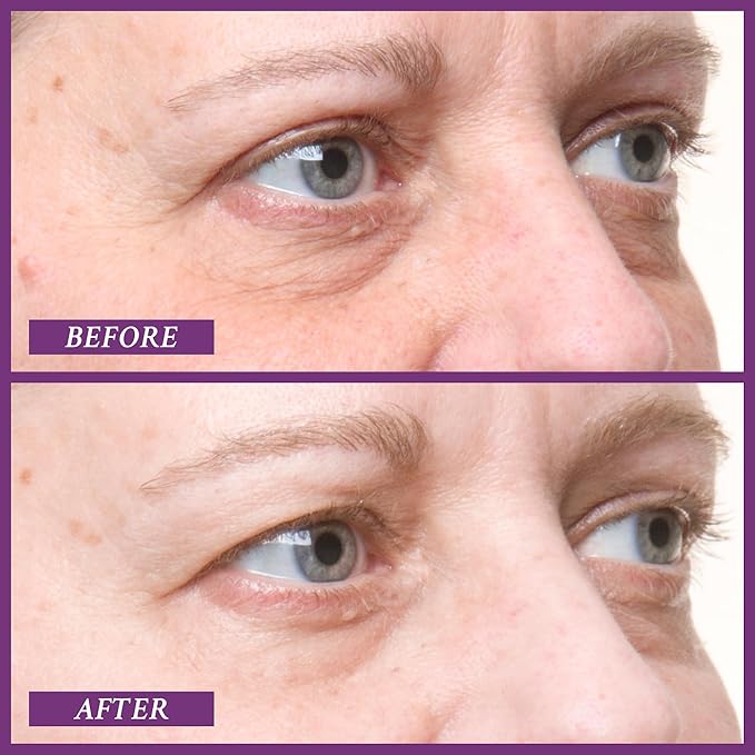 PRAI Beauty Ageless Eye D-Crease, Anti-Aging Eye Cream for Instantly Ageless-Looking Eyes, Under Eye Cream