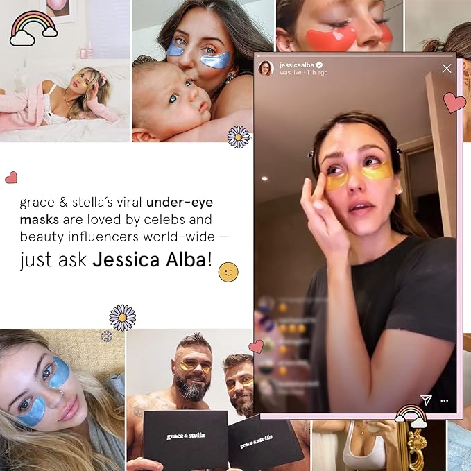 grace & stella Award Winning Under Eye Mask - Travel Essentials - Birthday Gifts for Women - Gel Eye Patches for Dark Circles, Puffy Eyes, Wrinkles, Undereye Bags - Vegan - Self Care (24 Pairs, Gold)