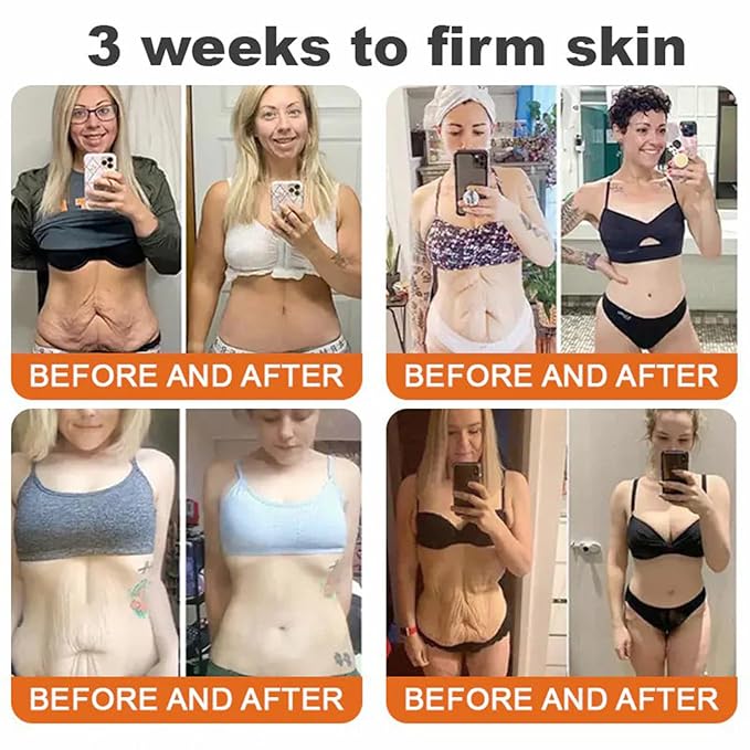 Botox Bee Venom Firming Serum Stick, Advanced Firming & Wrinkle-Reducing Cream, Bee Venom Wrinkle Remover Cream, Bee Venom Firming Serum Stick, Hydrates & Nourishes Skin (2PCS)