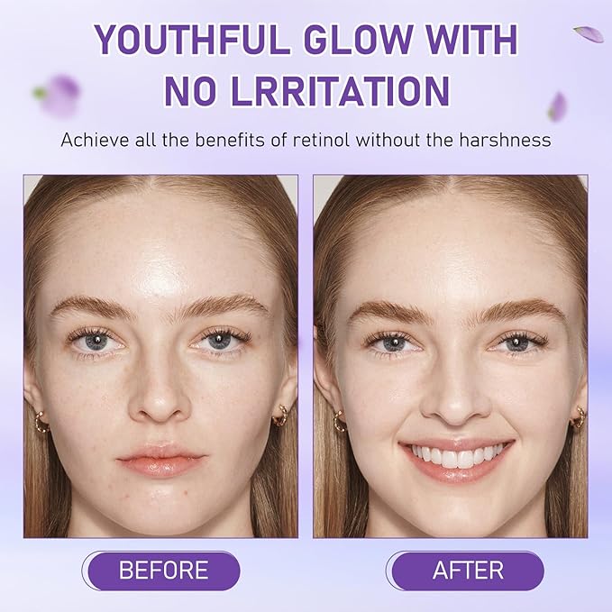 Bakuchiol Oil Organic, Natural Bakuchiol Serum for Face, Vegan Retinol Alternative with Squalane, Sensitive Skin Safe Soothes Irritated Skin, Reduces Fine Lines, Wrinkles(2Pcs- 2 Fl.oz)