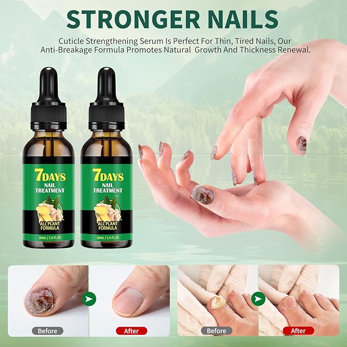 7days Ginger Nail Treatment 2Pcs Nail Support Nail Care, Nail Treatment, Ginger Nail Growth Serum, Ginger Cuticle Care Oil for Nails,Cuticle Serum for Nails
