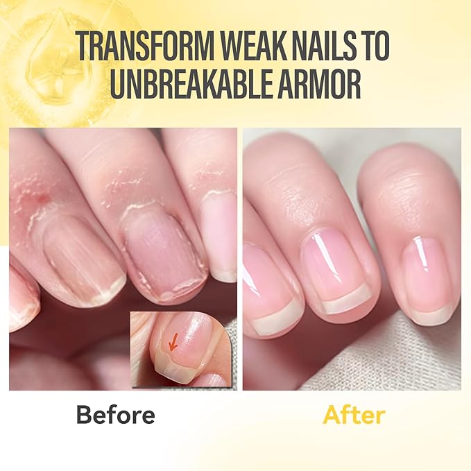 CHUCHU Nail Strengthener - Pineapple Scent Nail Repair Growth Moisturizing Treatment - Natural Jojoba Vitamin B & E Cuticle Oil for Dry Cracked Nails