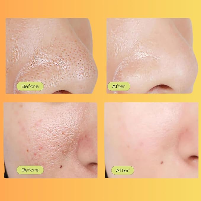 Pore Minimizer, Facial Essence for Minimizing the Appearance of Pores, Pore Minimizer Serum for Face, Even Skin Tone, Relieving Dryness, Oil Control Firming