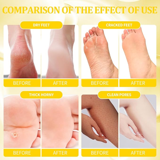 Pedicure Kit Foot Soak Set: Bubble Salt, Sugar Scrub, Massage Mask, Massage Lotion in a Box, 4 Step Foot Spa Kit for Dry Feet, Calluses and Tired Feet(3 Set Milky Flower)