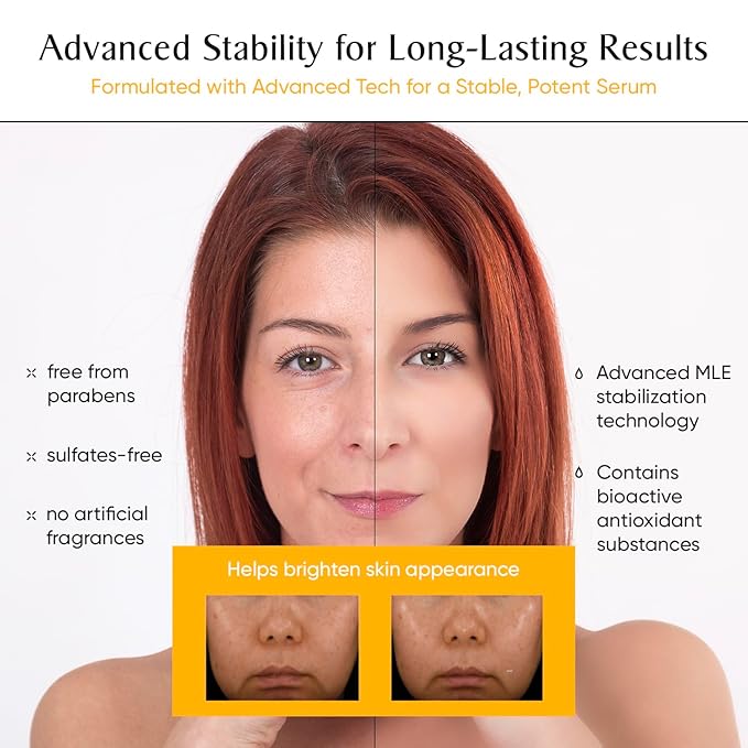 Lys by Misa Korean Vitamin C Serum for Face - For a Radiant Glow - Advanced Skincare with Vitamin E, Ferulic Acid & Arbutin - Brightens, Hydrates & Protects All Skin Types - Made in Korea