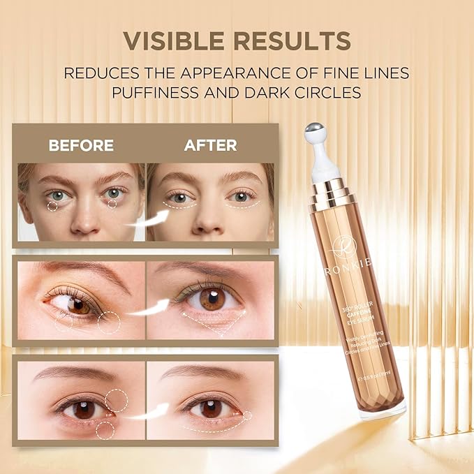 Eye Cream for Dark Circles: Under Eye Cream with Caffeine Retinol - Reduces Under Eye Bags and Fine Lines Gold