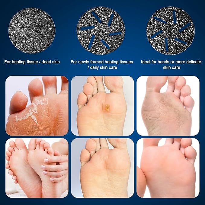 Electric Foot Callus Remover, IPX7 Waterproof Pedicure Kit Rechargeable Calloused Feet Remover Tool with LCD Display, 2-Speed Dual Motors for Efficient Exfoliation of Dead Skin on Feet