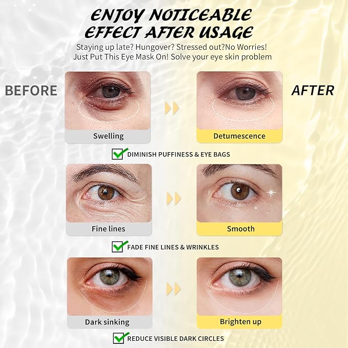 Under Eye Patches (8 Pairs), Caffeine Eye Masks for Dark Circles Puffy Eyes Undereye Bags, Collagen Eye Patches for Wrinkles and Puffiness, Skin Care Gift for Her