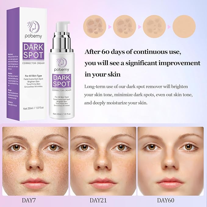 Dark Spot Remover for Face Body, Dark Spot Corrector Cream for Sun Spots, Age Spots, Brown Spots, Melasma Natural Dark Spot Remover Skin Care with Niacinamide Vitamin C for Women (1.0 Fl Oz)