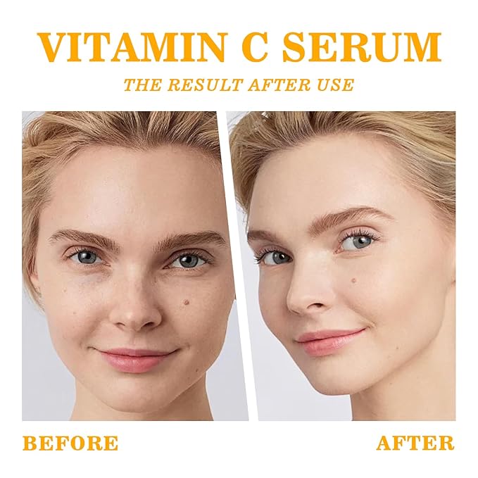 Skin Care Vitamin C Face Serum 1.05oz and Gua sha Facial Tool for Face with Hyaluronic Acid,Hydrolyzed Collagen and Aloe Leaf Extract, Anti-Aging Serum for Wrinkles & Dark Spot