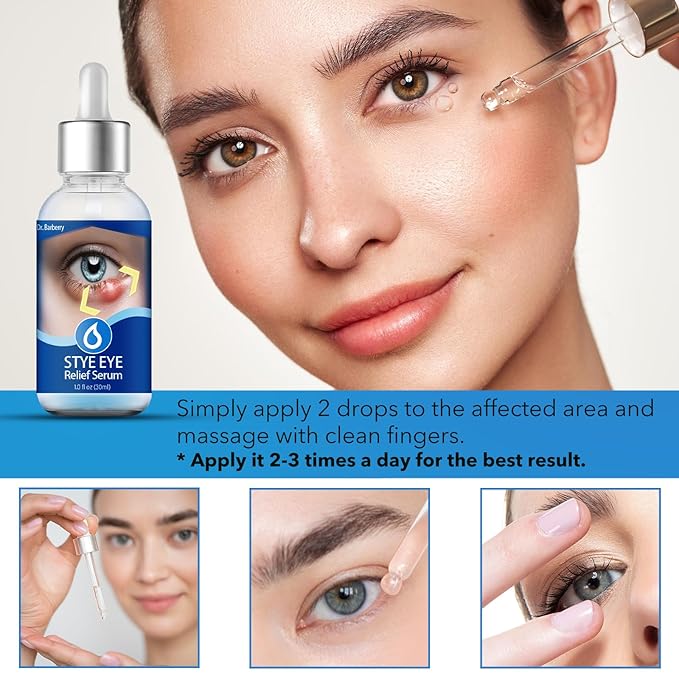 Stye Eye Treatment, Natural Stye Remover, Eye Stye Relief Serum, Premium Formula - Gentle Cleanser for Chalazion & Blepharitis (1 Fl Oz (Pack of 1))