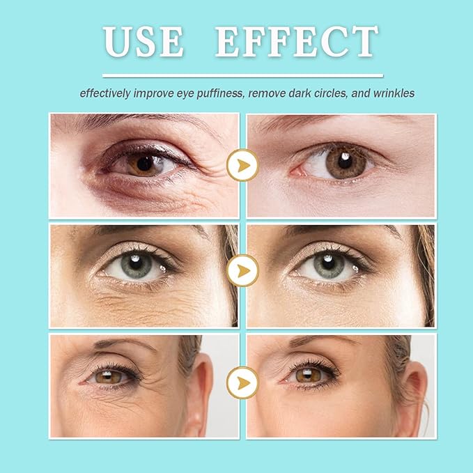 28 Pairs Collagen Eye Mask, Anti Wrinkle Eye Patches for Puffy Eyes and Dark Circles, Natural Marine Collagen Eye Gel Pads for Puffiness, Eye Treatment Skin Care for Puffiness Wrinkle Eye Bags