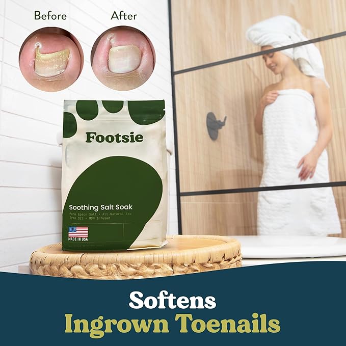 Footsie Soothing Tea Tree Oil Epsom Salt Soak - for Calluses, Aches & Pain, Athlete's Foot - Made in USA - Soothes Cracked Heels, Flaky Skin - 100% Organic, Pedicure Spa Salt (Toenail Repair)
