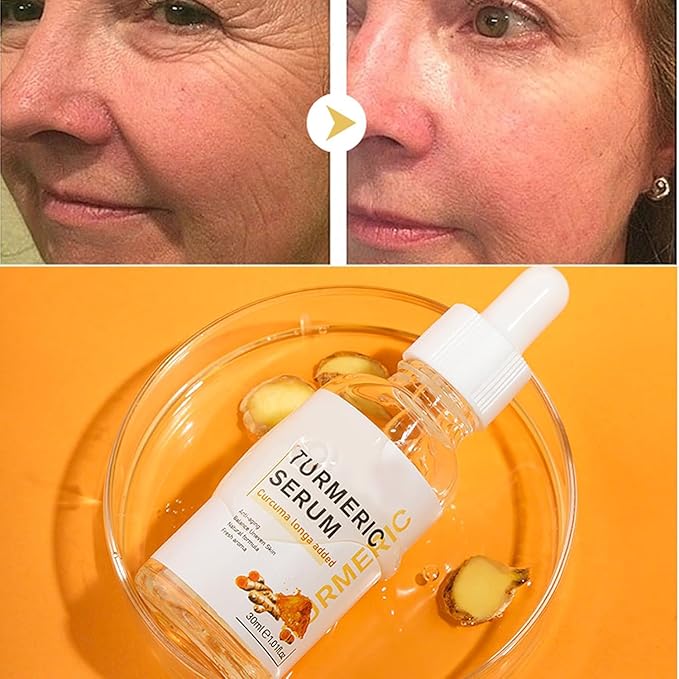 Lumibalm for urmeric Dark Spot Serum Oil, Turmeric Face Serum Oil, Bright Skin Dark Spot Corrector Face,Turmeric Facial Serum,Turmeric Face Serum Oil,Turmeric Face Oil Moisturizing.